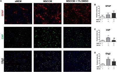 Dimethylsulfoxide Inhibits Oligodendrocyte Fate Choice of Adult Neural Stem and Progenitor Cells